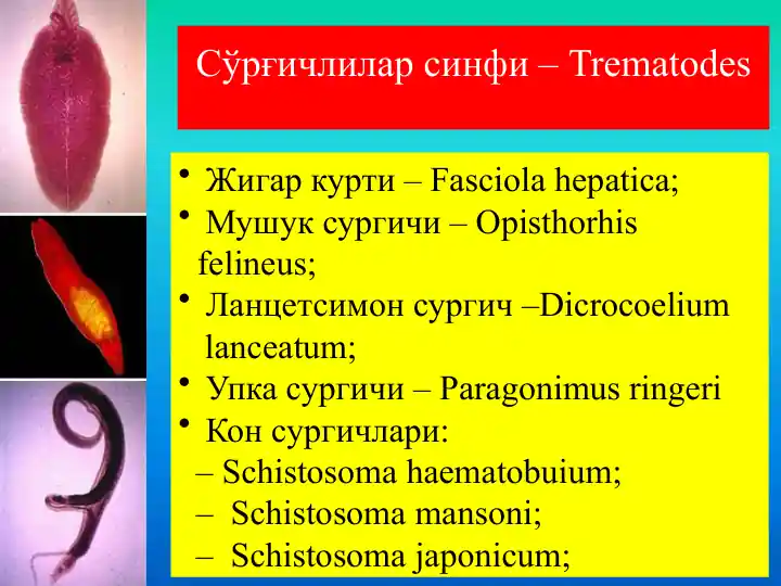 So'rg'ichlilar sinfi-Trematodes
