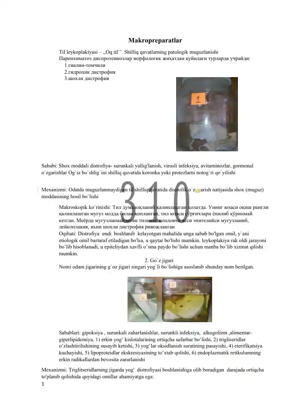 Til leykoplakiyasi – ,,Oq til’’  Shilliq qavatlarning patologik muguzlanishi