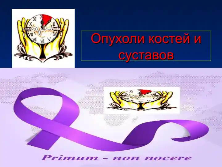 Опухоли костей и суставов