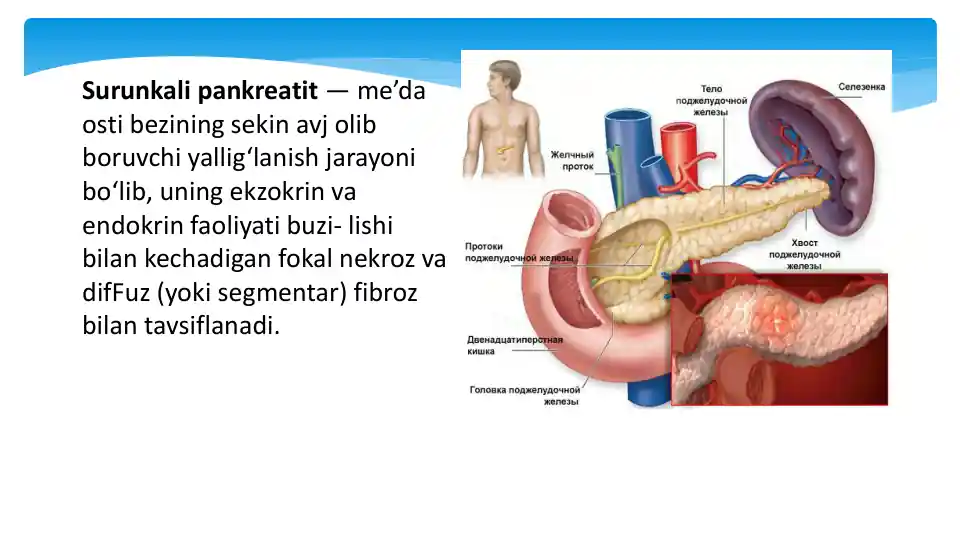card img