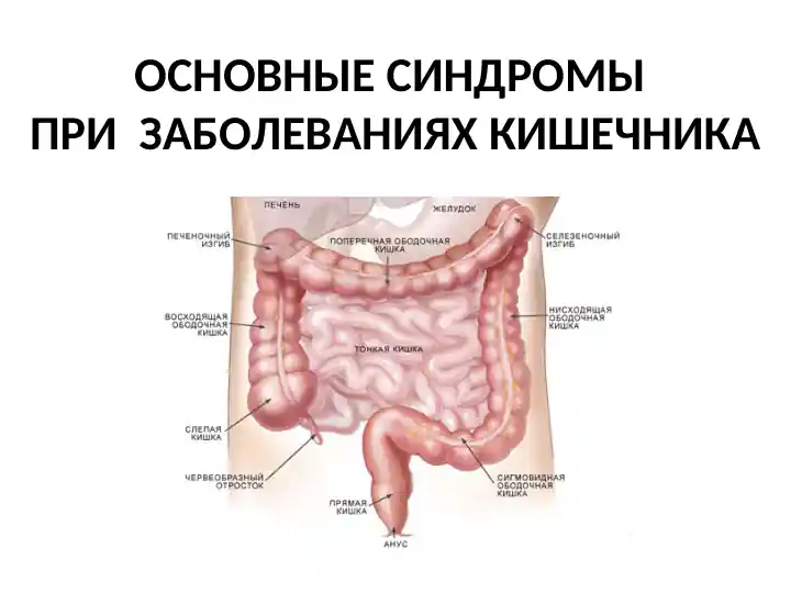 ОСНОВНЫЕ СИНДРОМЫ ПРИ ЗАБОЛЕВАНИЯХ КИШЕЧНИКА