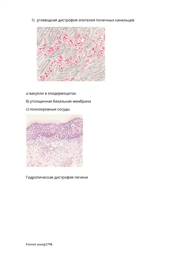 taqdimotlar-biologiya-zhirovaia-distrofiia-epiteliia-pochechnykh-kanaltsev