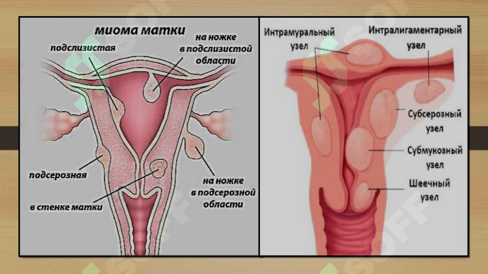 Onalar bilan ajoyib jinsiy aloqa