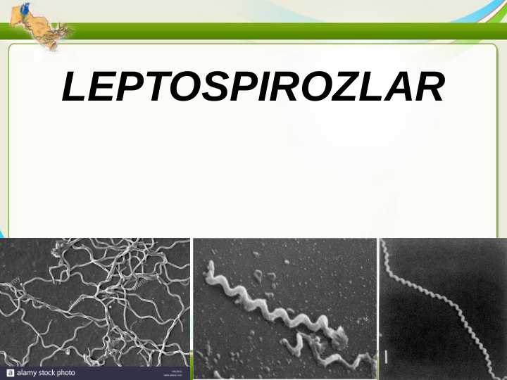 LEPTOSPIROZLAR
