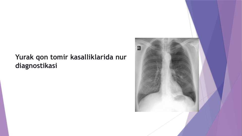 Eshakdagi oriq qizni sikish