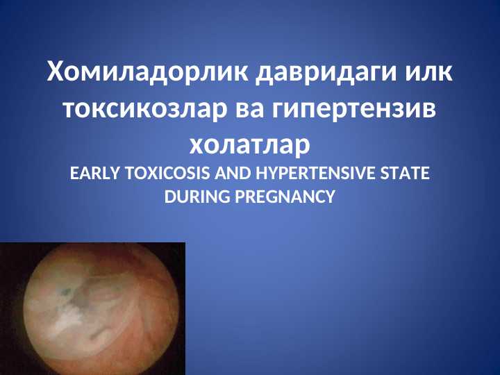 Хомиладорлик давридаги илк токсикозлар ва гипертензив холатларEARLY TOXICOSIS AND HYPERTENSIVE STATE DURING PREGNANCY