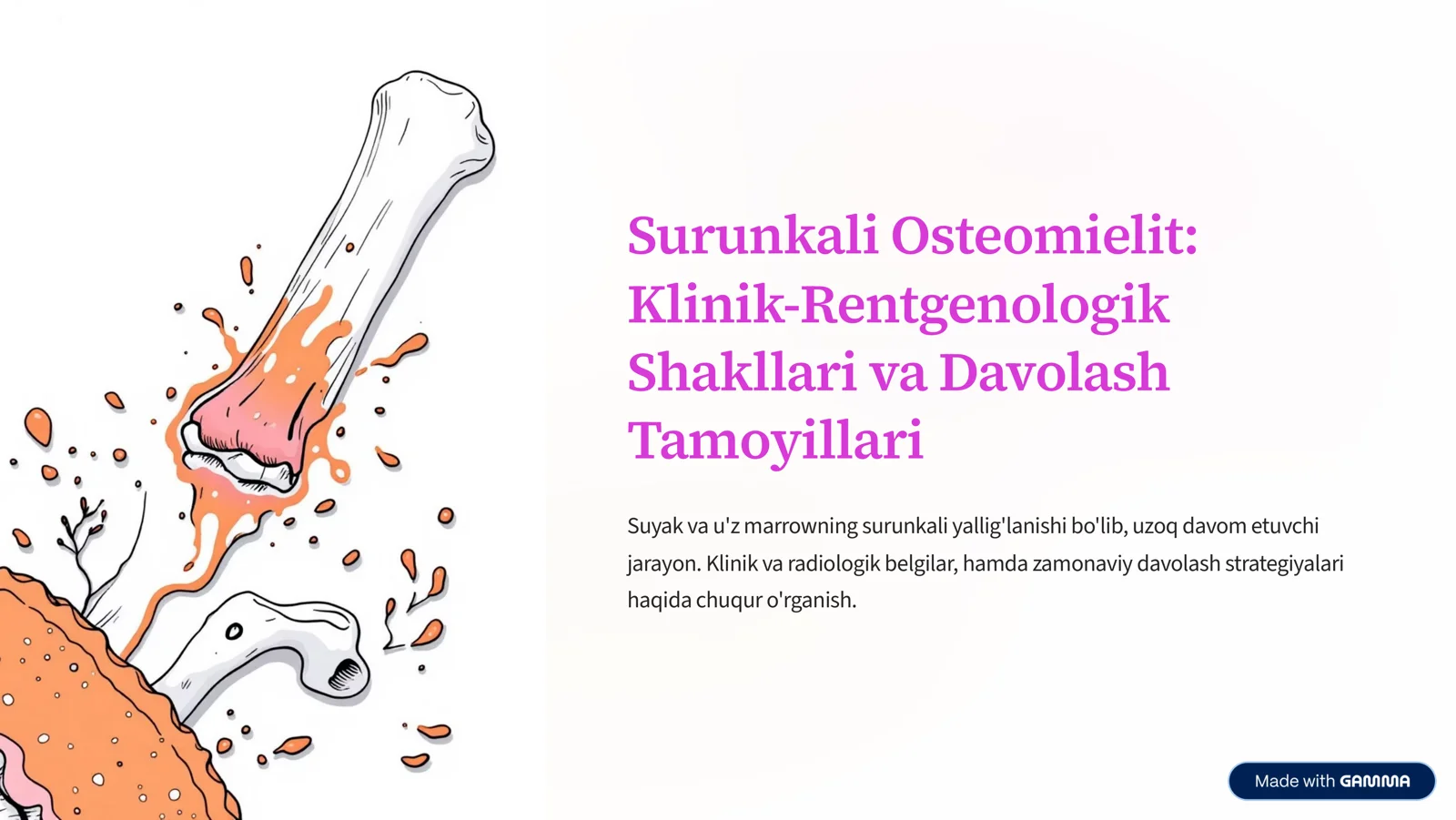 Surunkali Osteomielit: Klinik-Rentgenologik Shakllari va Davolash Tamoyillari