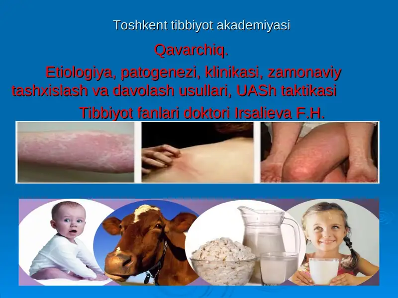 Крапивница