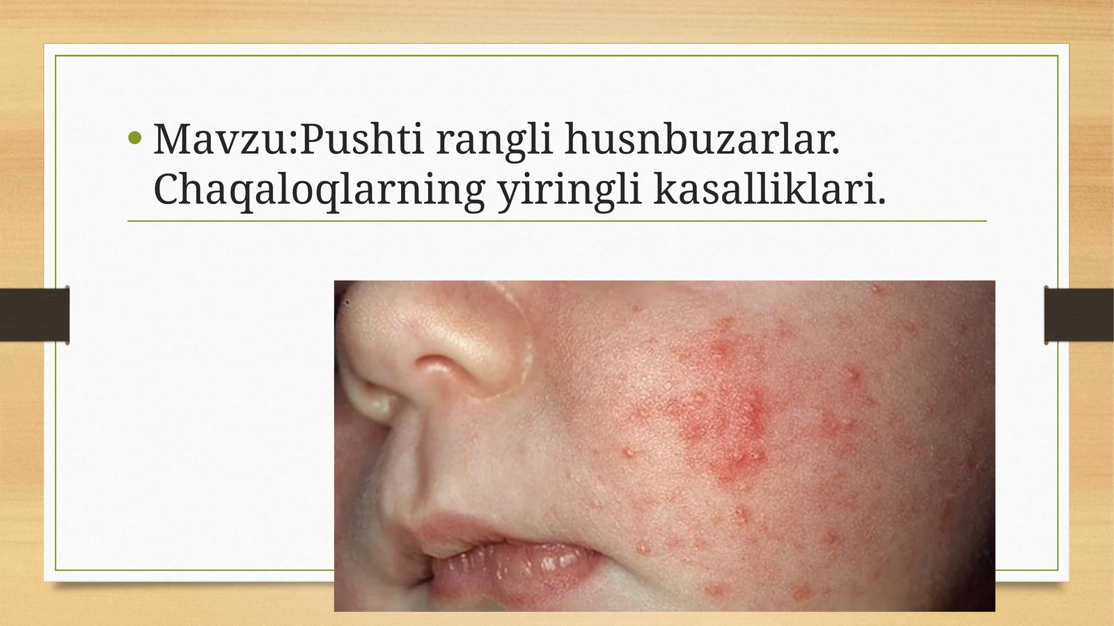Pushti rangli husnbuzarlar. Chaqaloqlarning yiringli kasalliklari.