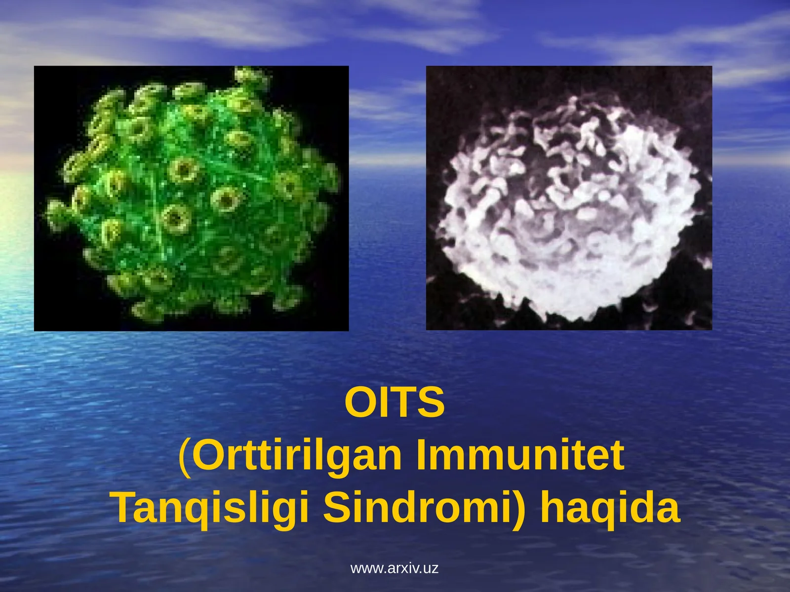 OITS(Orttirilgan Immunitet Tanqisligi Sindromi) haqida