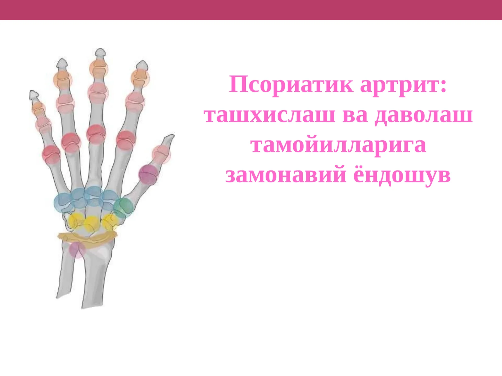 Псориатикартрит:ташхислашвадаволаштамойилларигазамонавийёндошув
