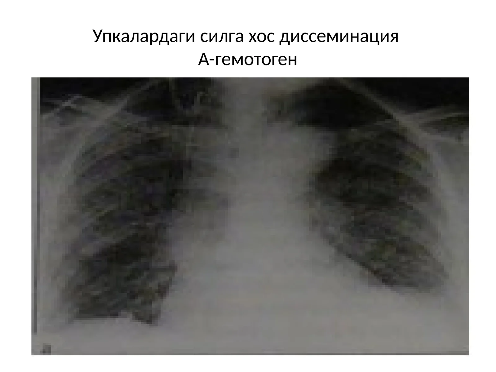 А-гемотоген