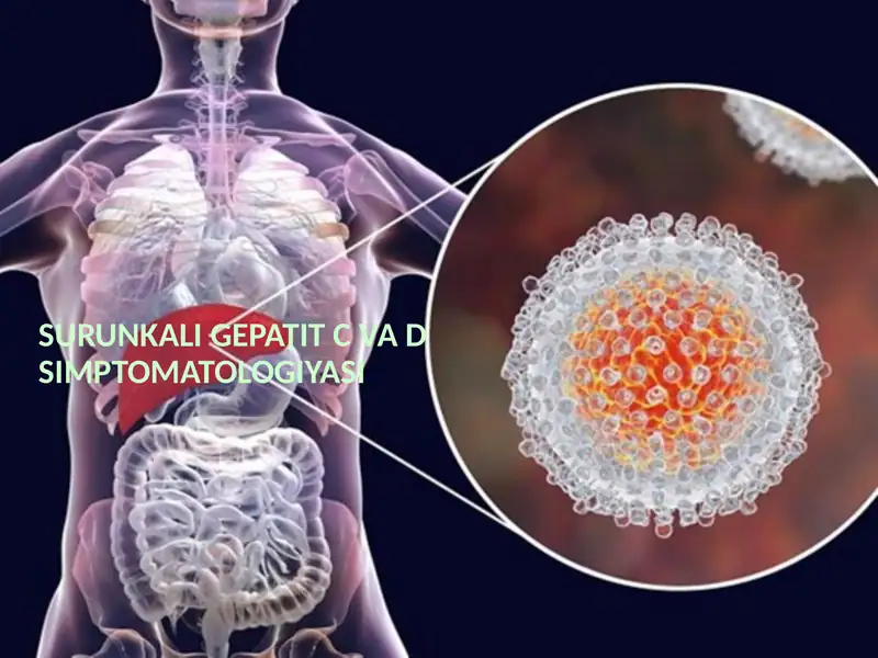 Gepatit C va D simptomatologiyasi