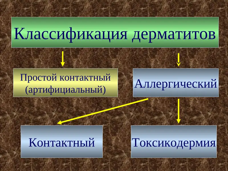 Классификация дерматитов