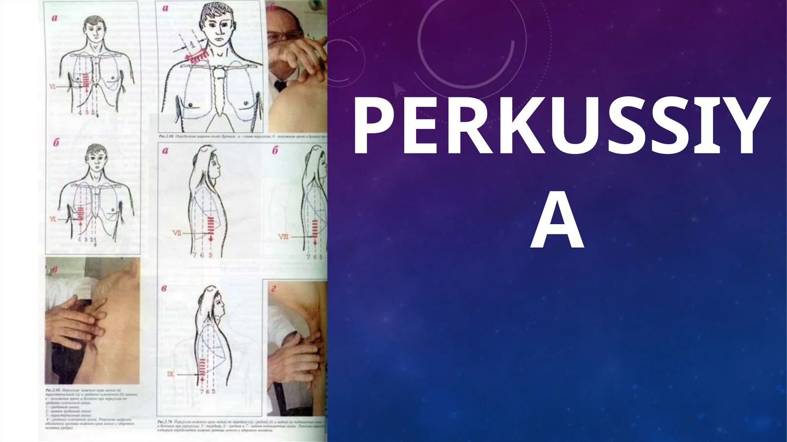 Perkussiya